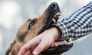 How Meyers Personal Injury Law Can Help Me Recover Compensation for Dog Bite Injuries in Nashville